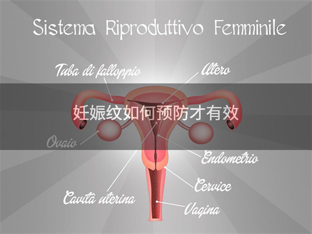 妊娠纹如何预防才有效