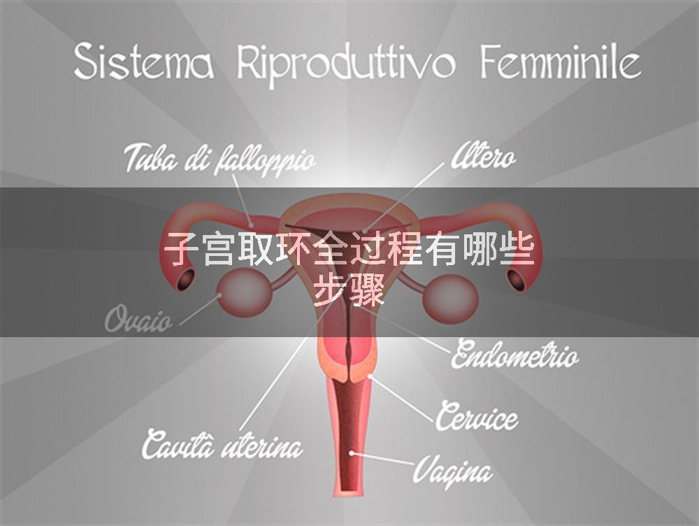 子宫取环全过程有哪些步骤