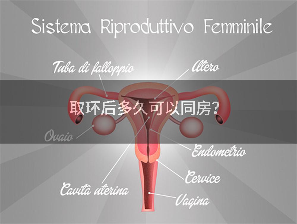 取环后多久可以同房？