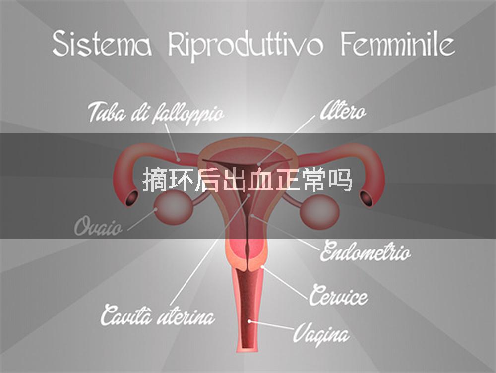 摘环后出血正常吗