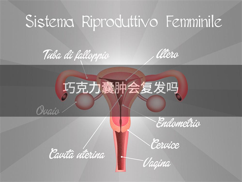 巧克力囊肿会复发吗