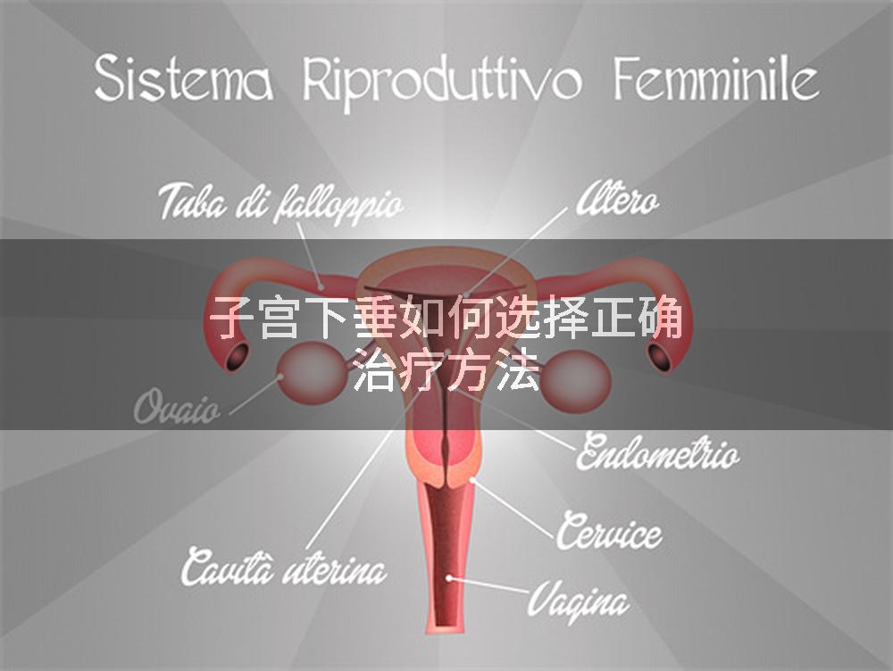子宫下垂如何选择正确治疗方法