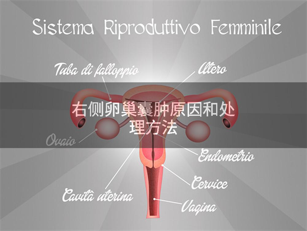 右侧卵巢囊肿原因和处理方法