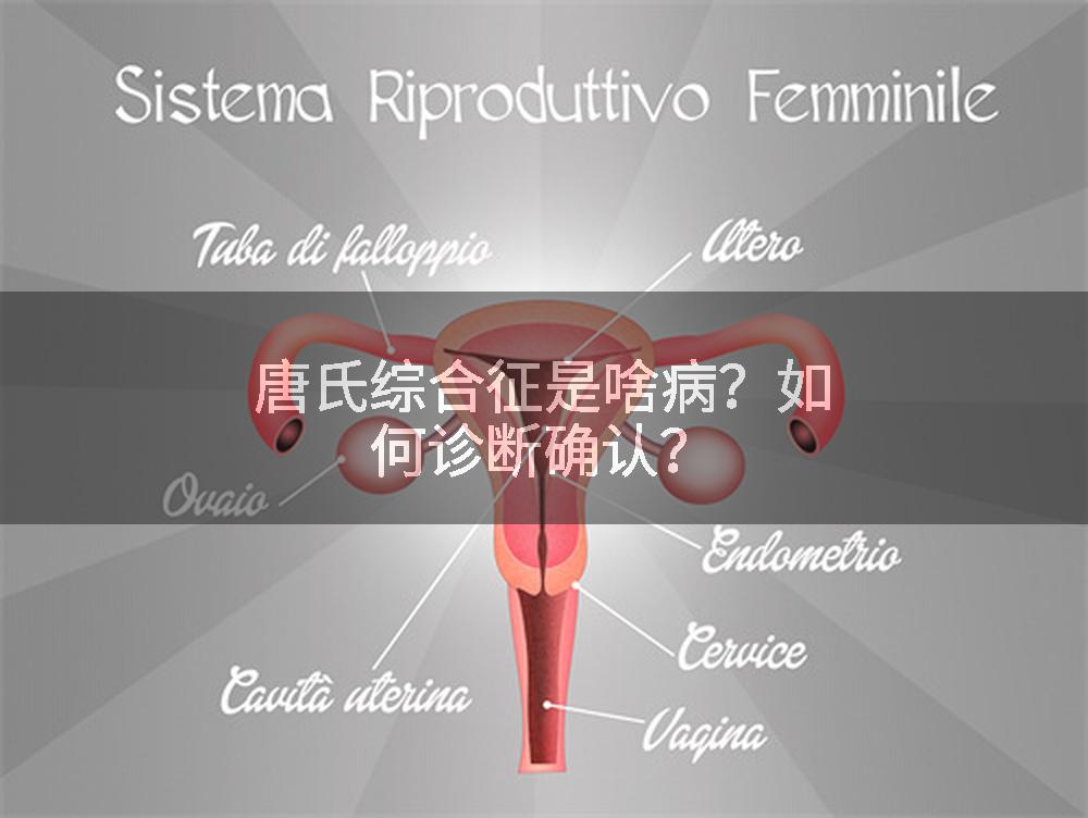 唐氏综合征是啥病？如何诊断确认？