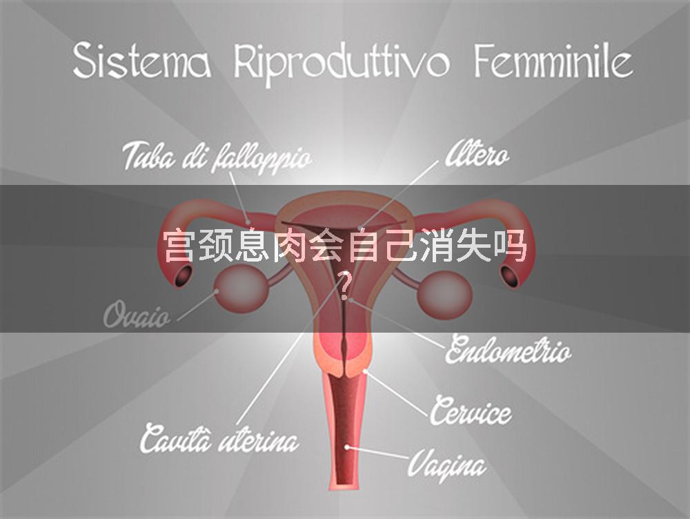 宫颈息肉会自己消失吗?