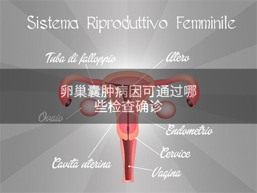 卵巢囊肿病因可通过哪些检查确诊