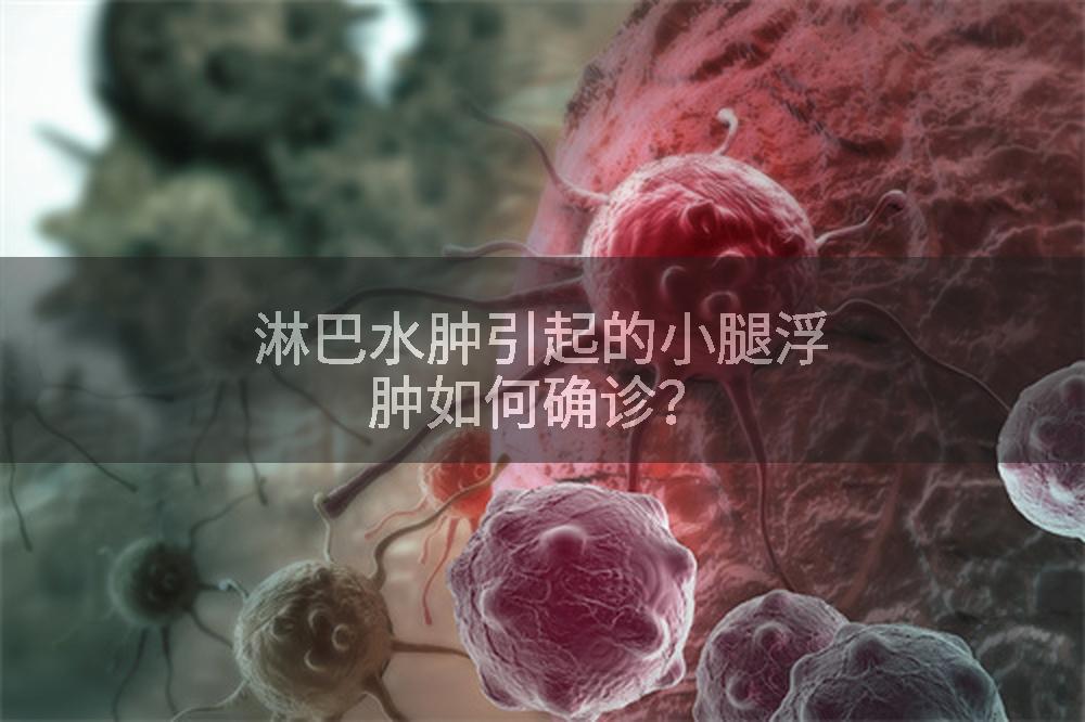 淋巴水肿引起的小腿浮肿如何确诊？