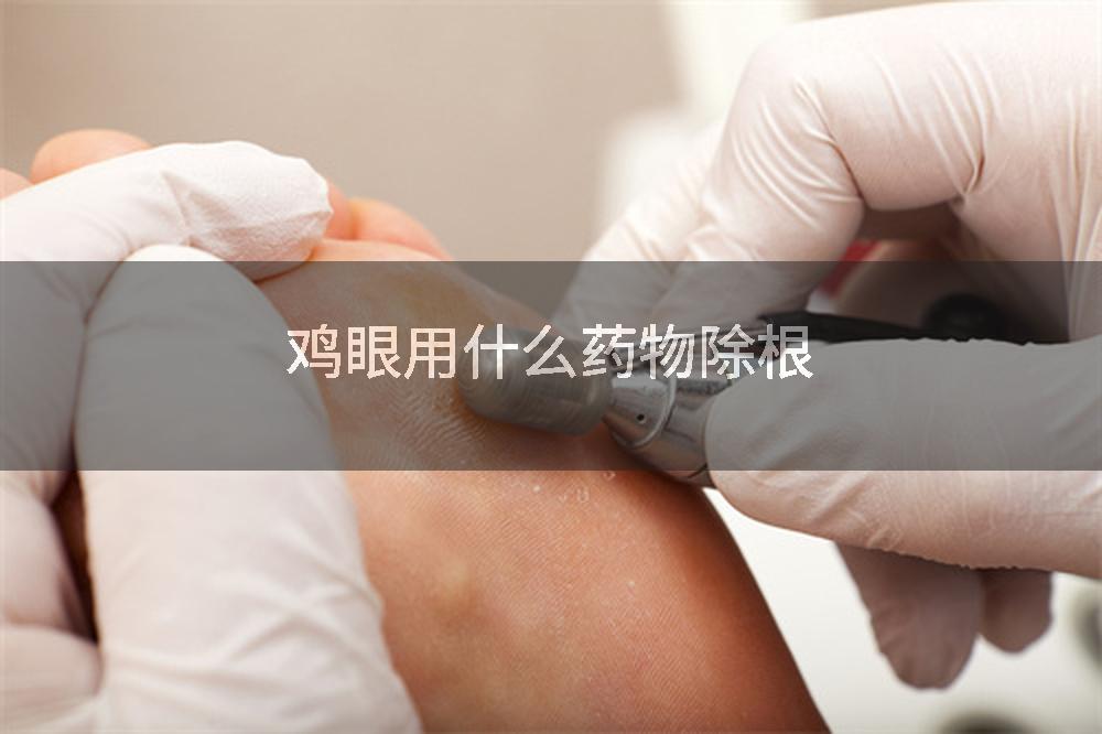 鸡眼用什么药物除根