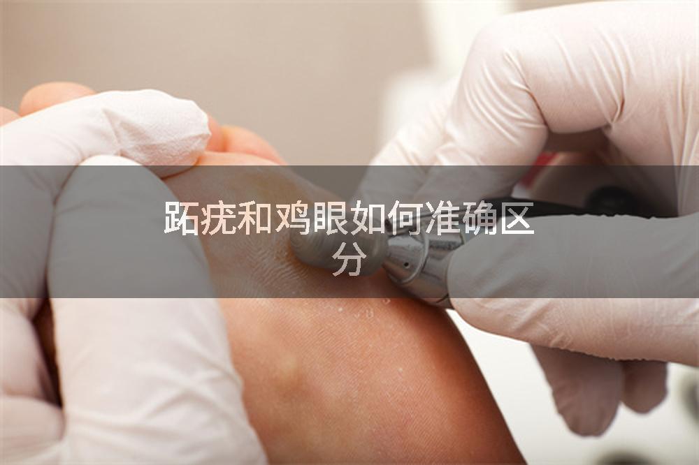 跖疣和鸡眼如何准确区分