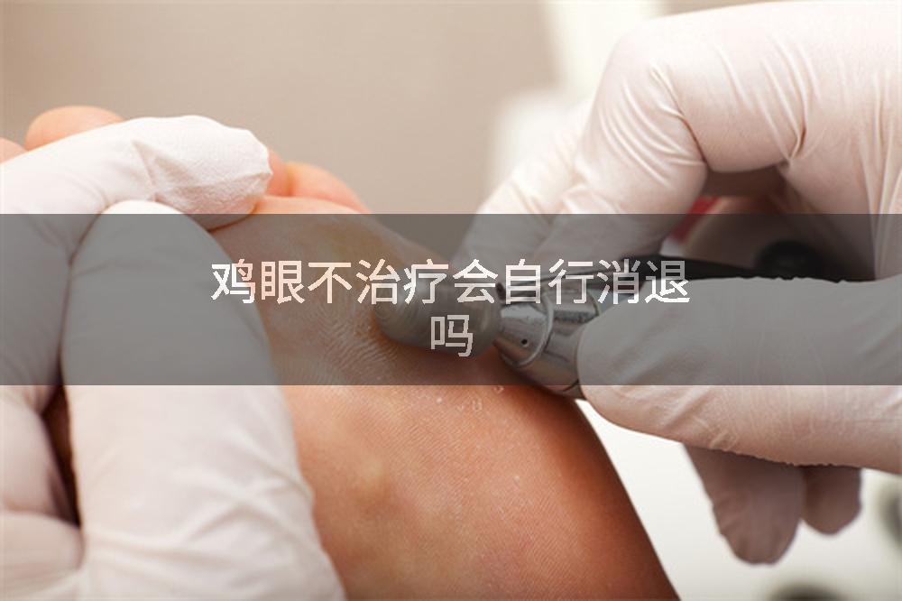 鸡眼不治疗会自行消退吗