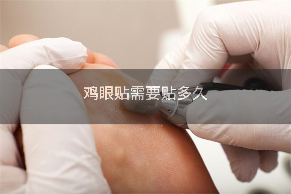 鸡眼贴需要贴多久
