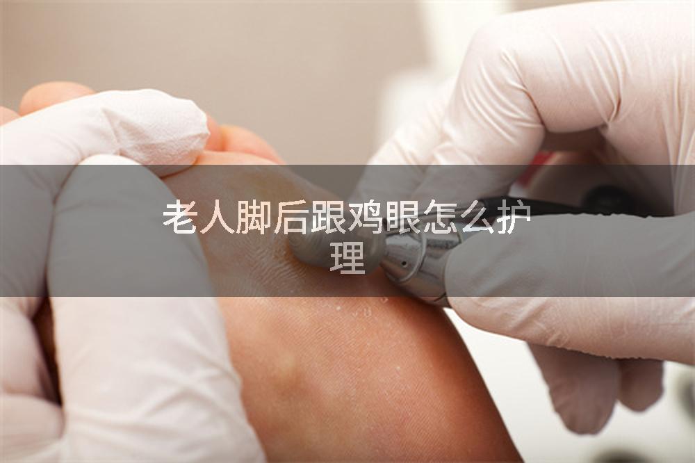 老人脚后跟鸡眼怎么护理