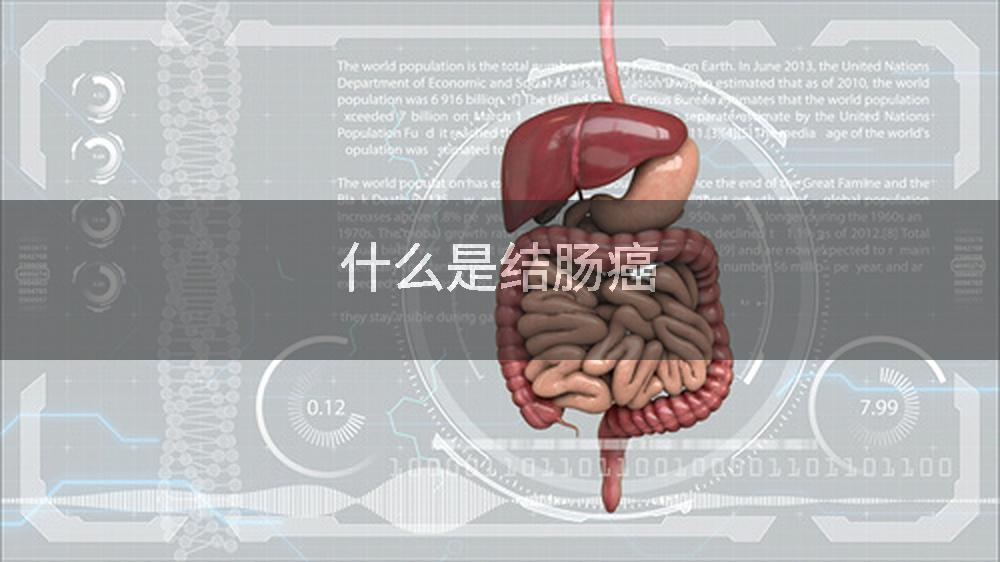 什么是结肠癌