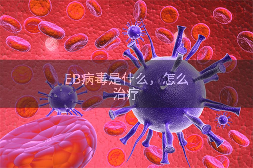 EB病毒是什么，怎么治疗