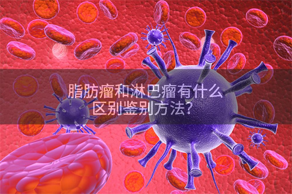 脂肪瘤和淋巴瘤有什么区别鉴别方法？