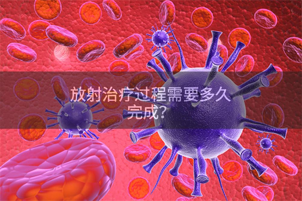 放射治疗过程需要多久完成？