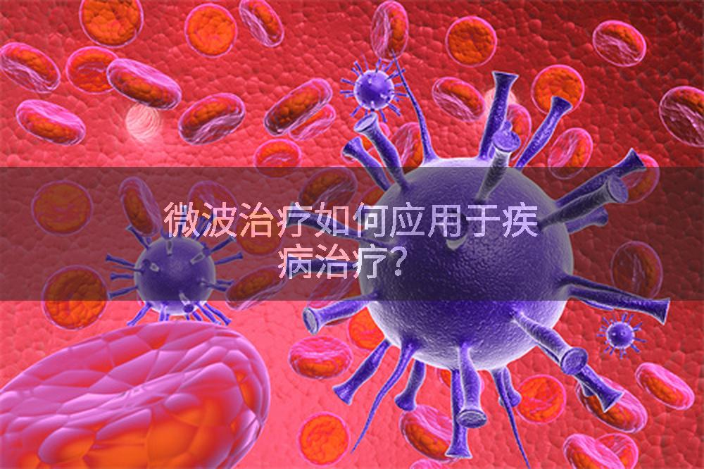 微波治疗如何应用于疾病治疗？