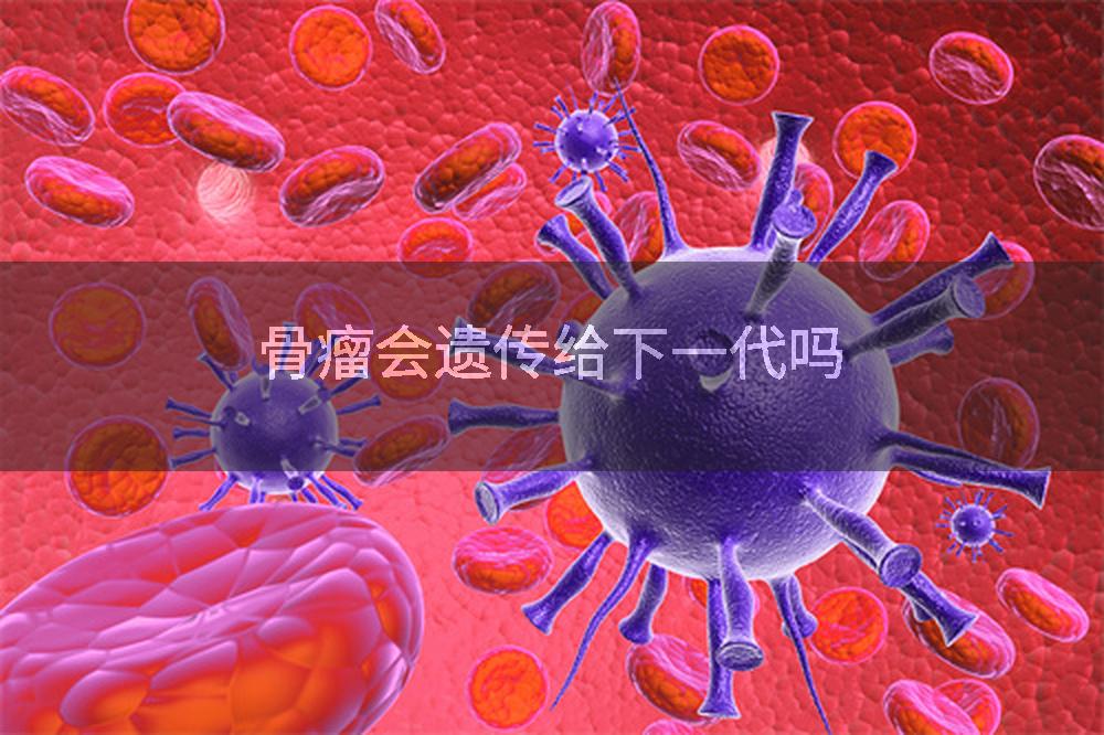 骨瘤会遗传给下一代吗
