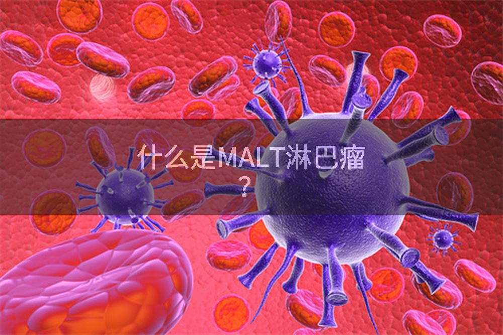什么是MALT淋巴瘤？