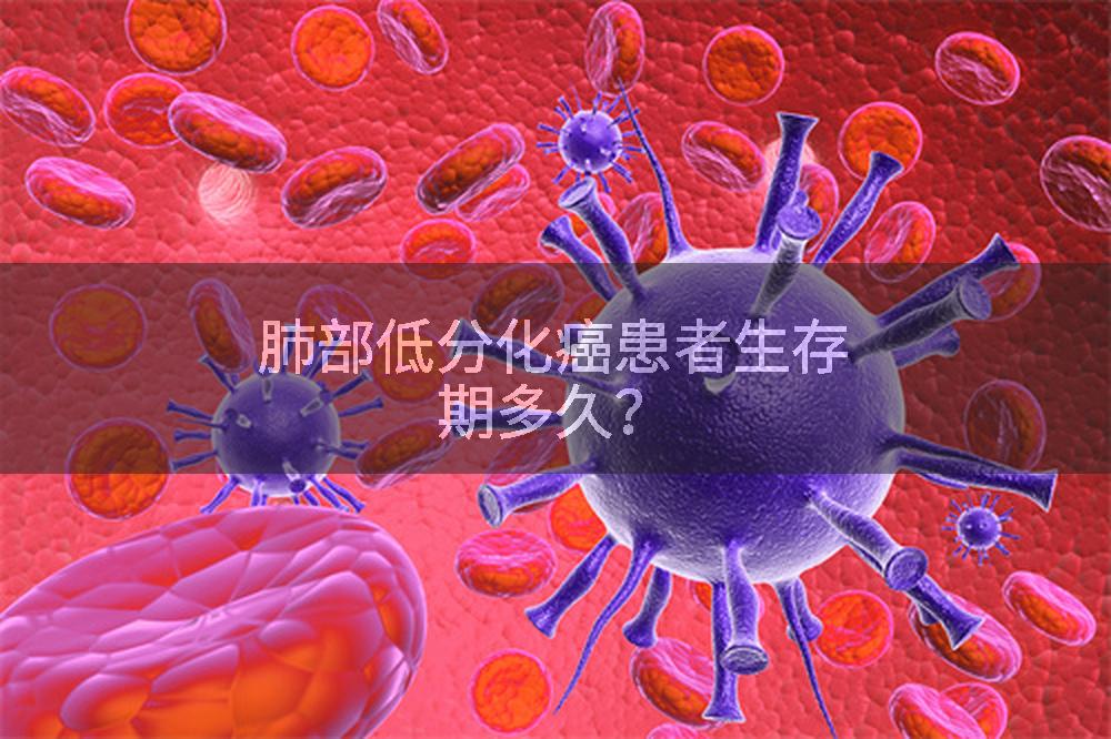 肺部低分化癌患者生存期多久？