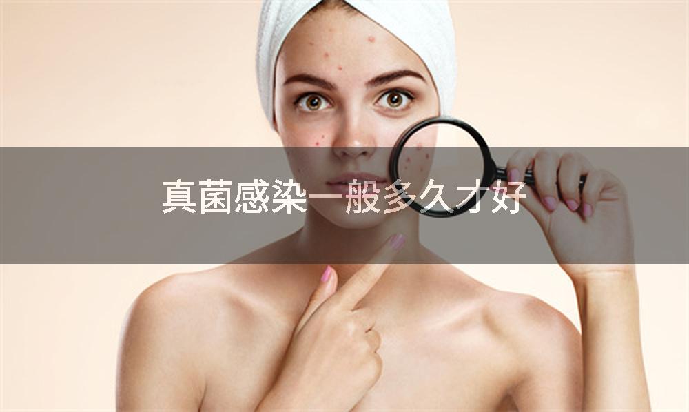 真菌感染一般多久才好
