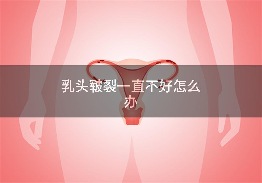 乳头皲裂一直不好怎么办