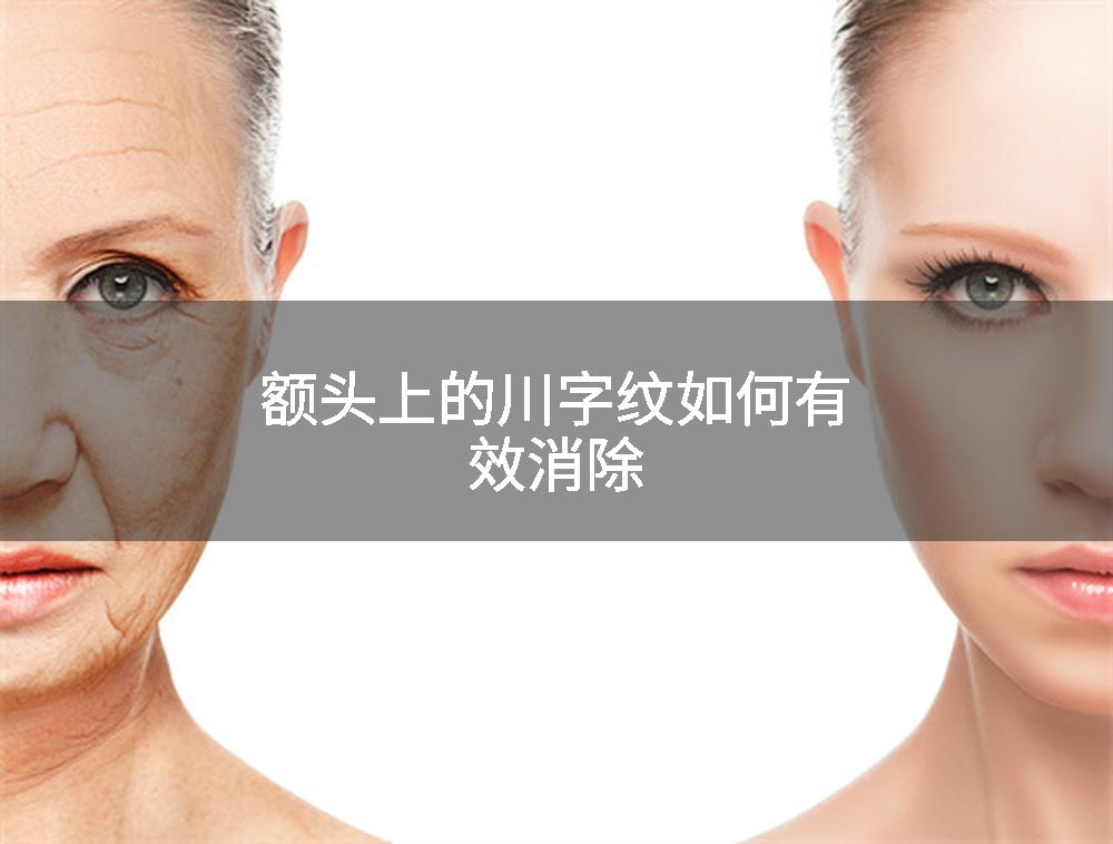 额头上的川字纹如何有效消除
