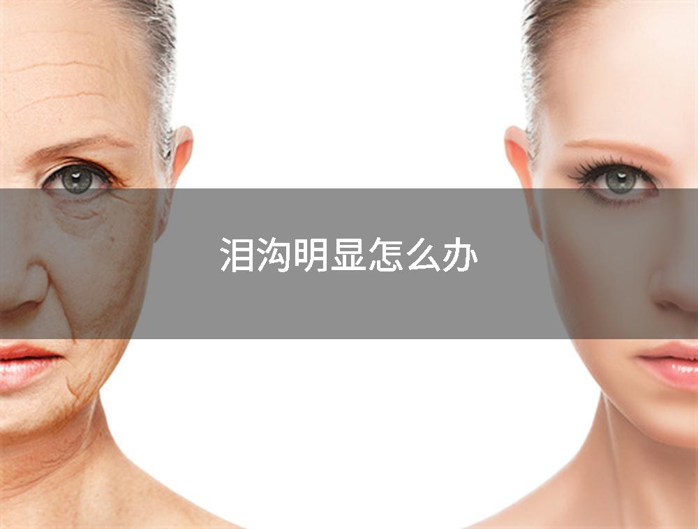 泪沟明显怎么办