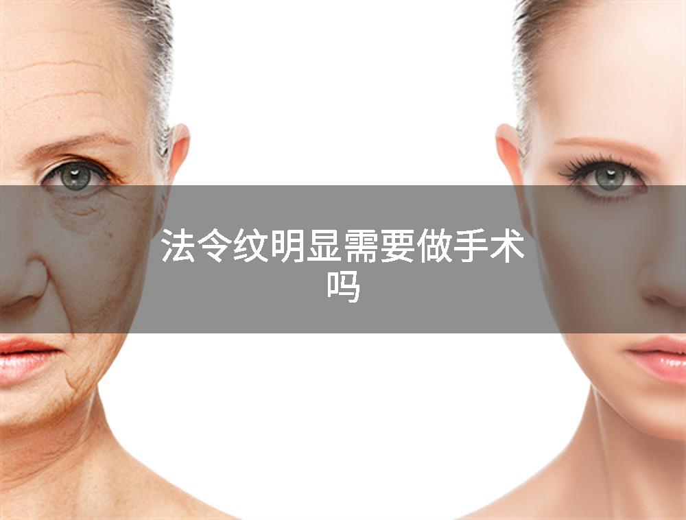 法令纹明显需要做手术吗