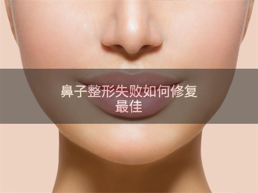 鼻子整形失败如何修复最佳