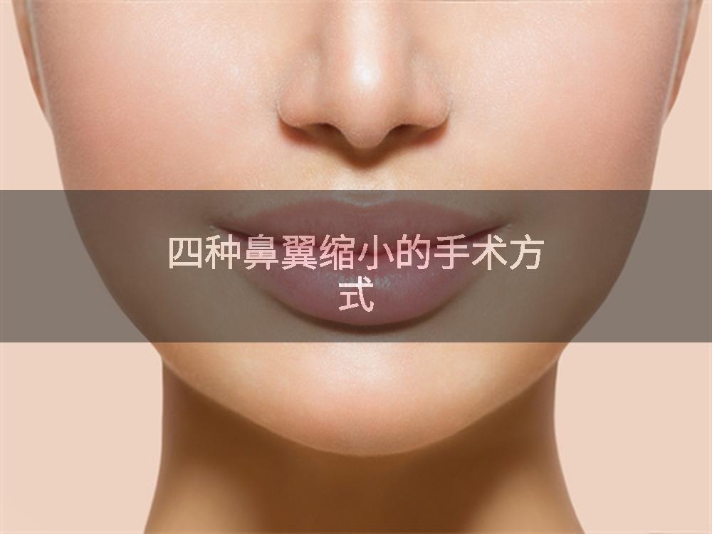 四种鼻翼缩小的手术方式