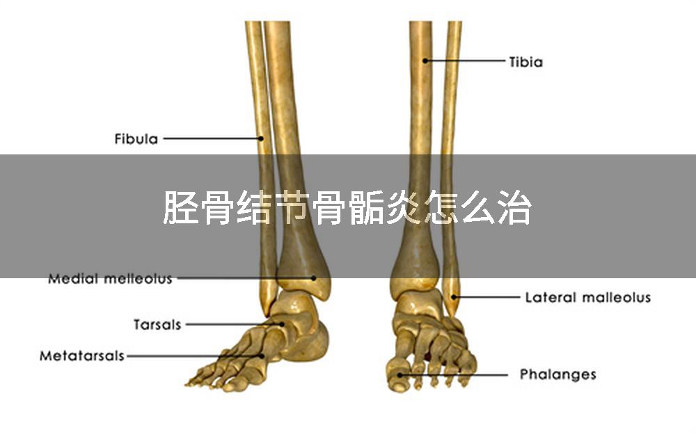 胫骨结节骨骺炎怎么治