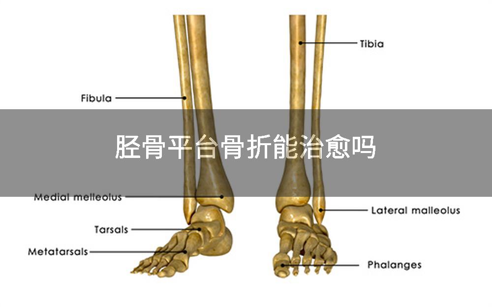 胫骨平台骨折能治愈吗