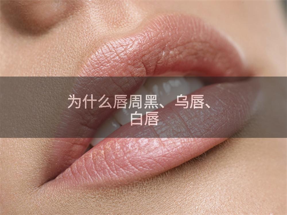 为什么唇周黑、乌唇、白唇