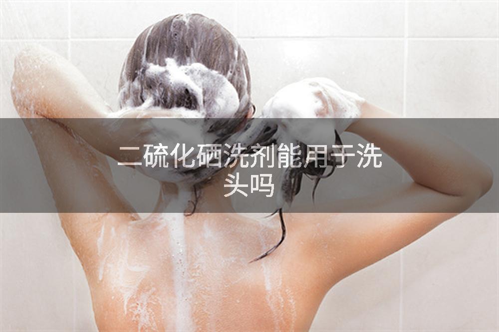 二硫化硒洗剂能用于洗头吗