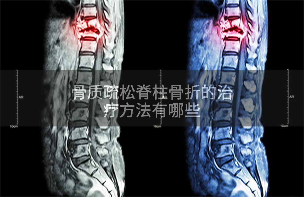 骨质疏松脊柱骨折的治疗方法有哪些