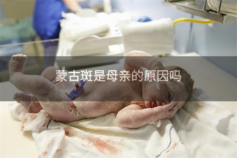 蒙古斑是母亲的原因吗