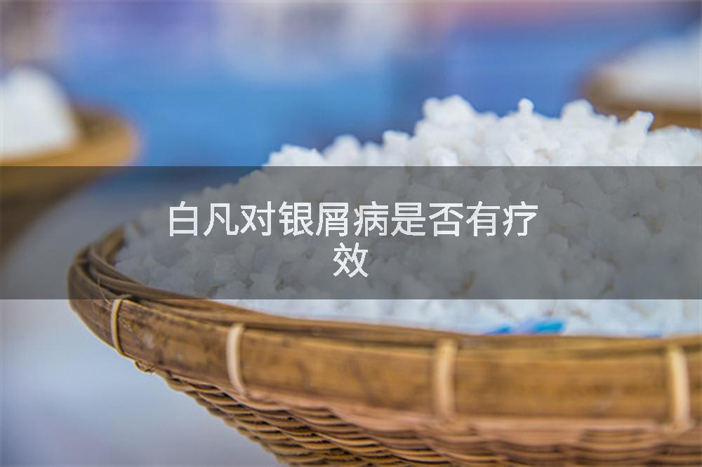 白凡对银屑病是否有疗效