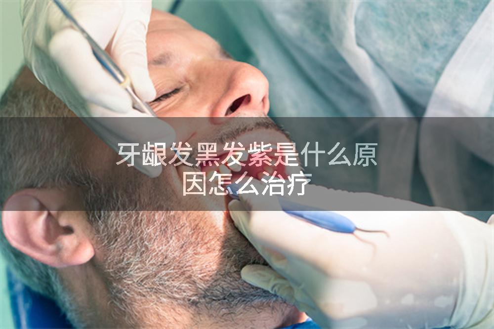 牙龈发黑发紫是什么原因怎么治疗