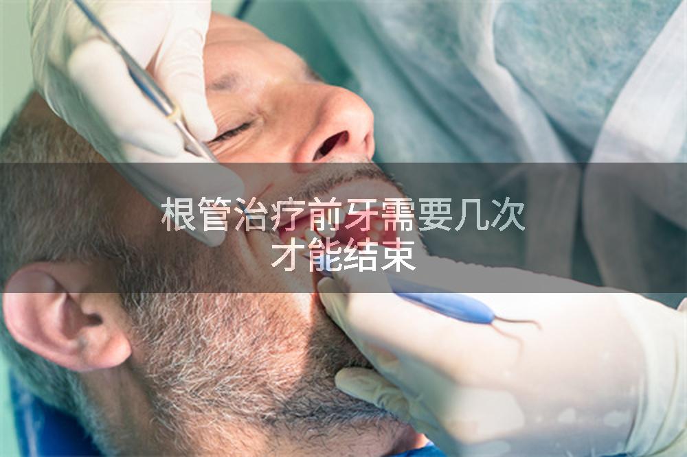 根管治疗前牙需要几次才能结束
