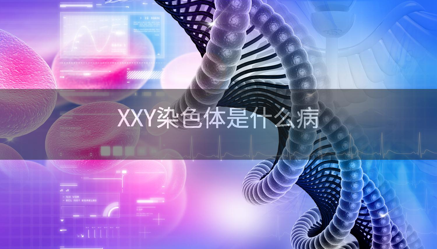 XXY染色体是什么病