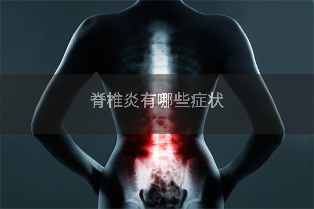 脊椎炎有哪些症状