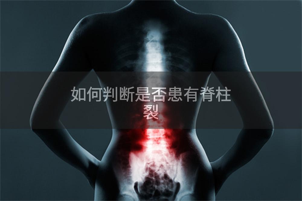 如何判断是否患有脊柱裂