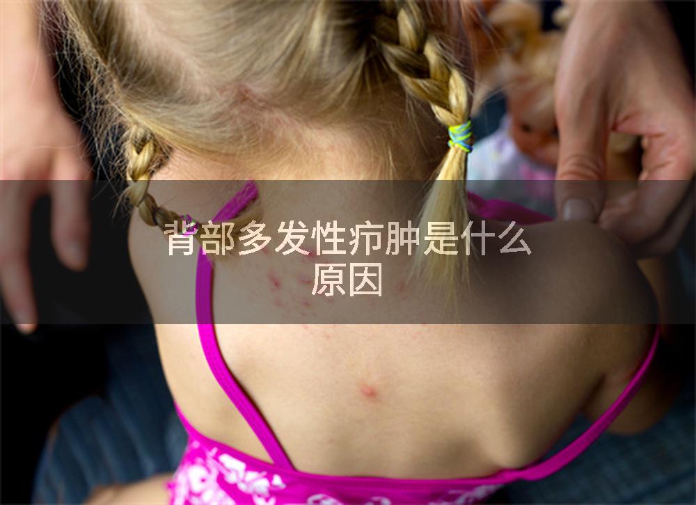 背部多发性疖肿是什么原因