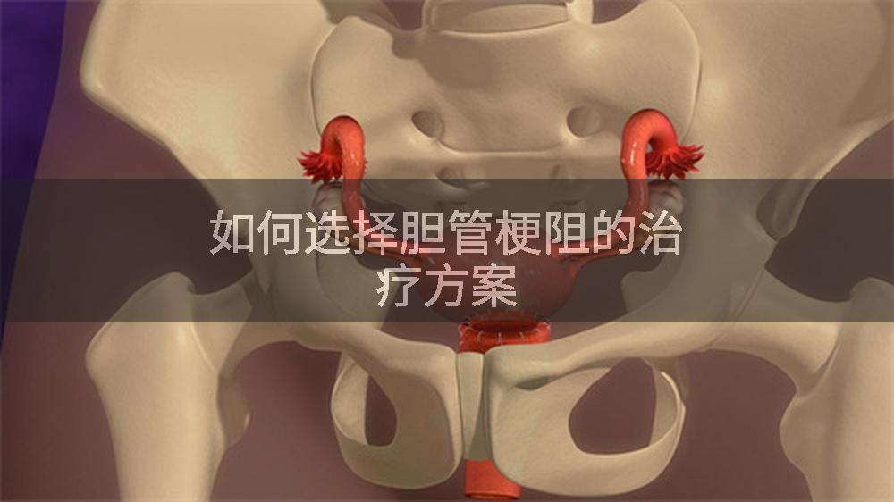 如何选择胆管梗阻的治疗方案