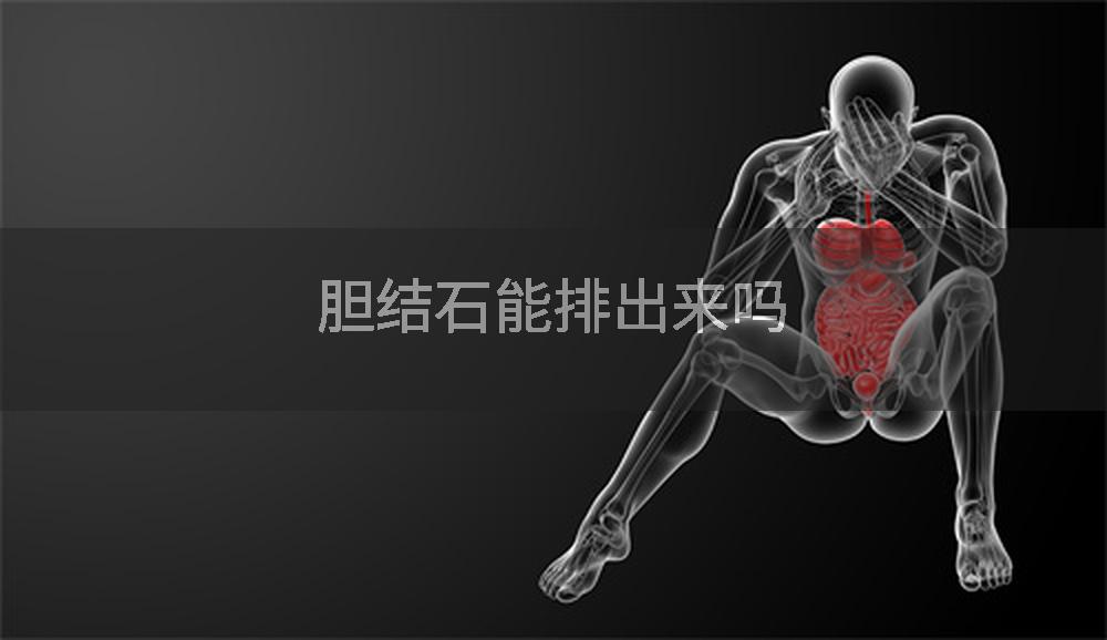 胆结石能排出来吗