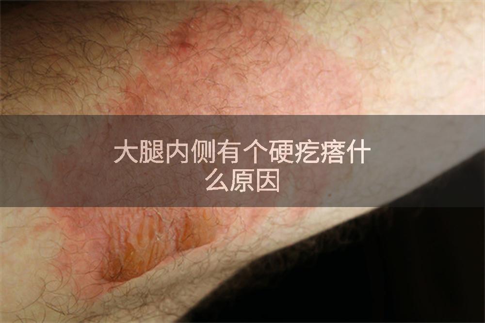 大腿内侧有个硬疙瘩什么原因