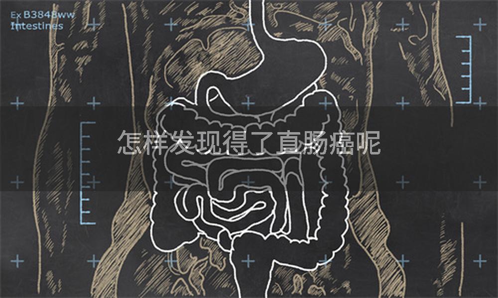 怎样发现得了直肠癌呢