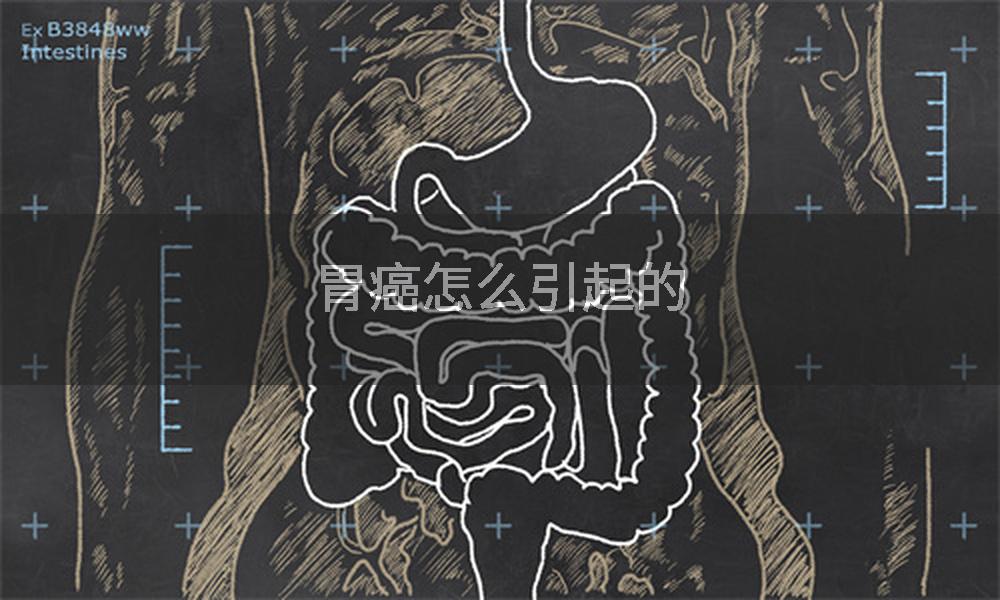 胃癌怎么引起的