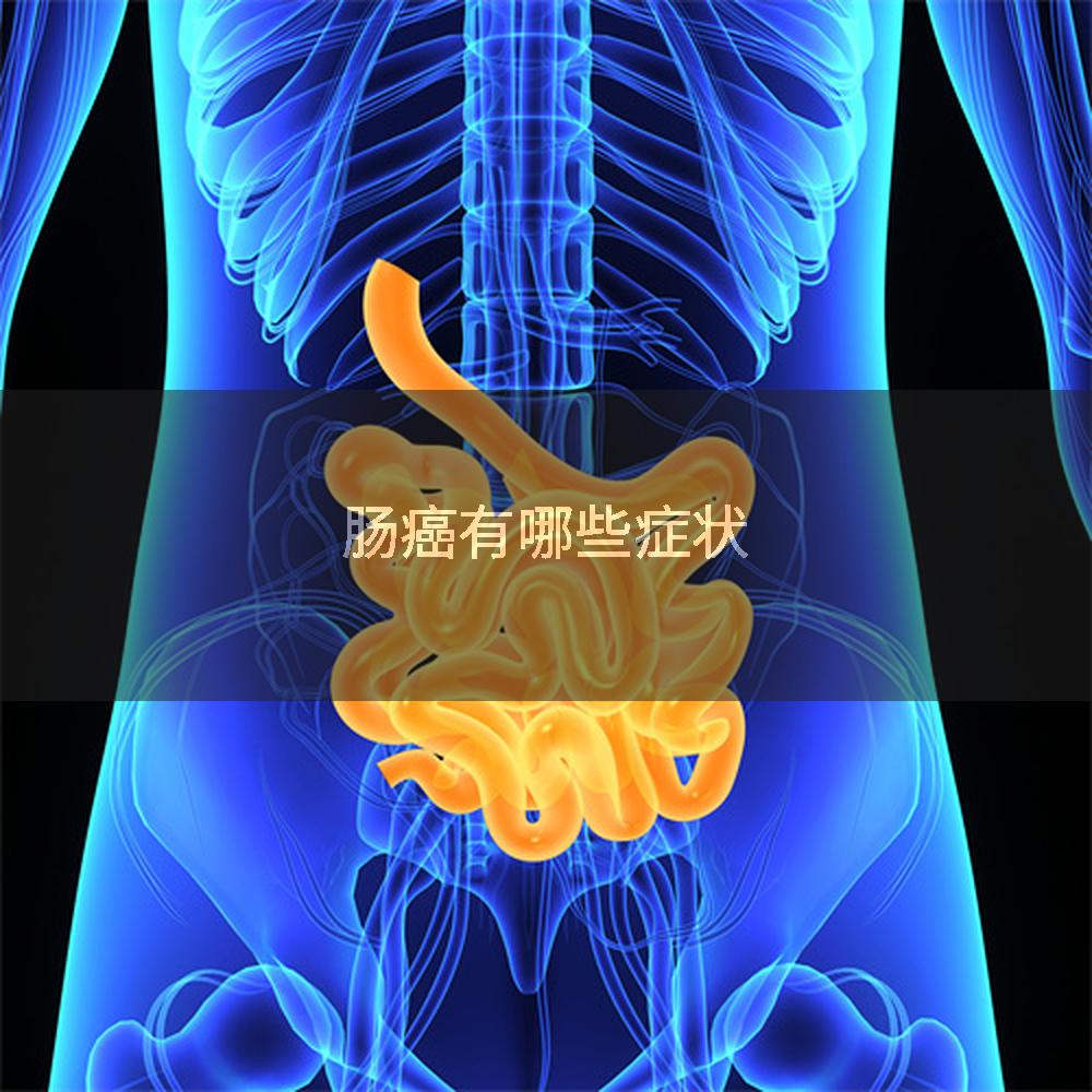 肠癌有哪些症状